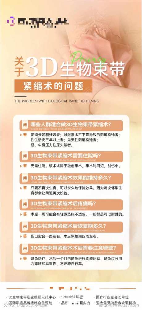 关于3D生物束带紧缩术的问题-采灵感-https://www.cailinggan.com/