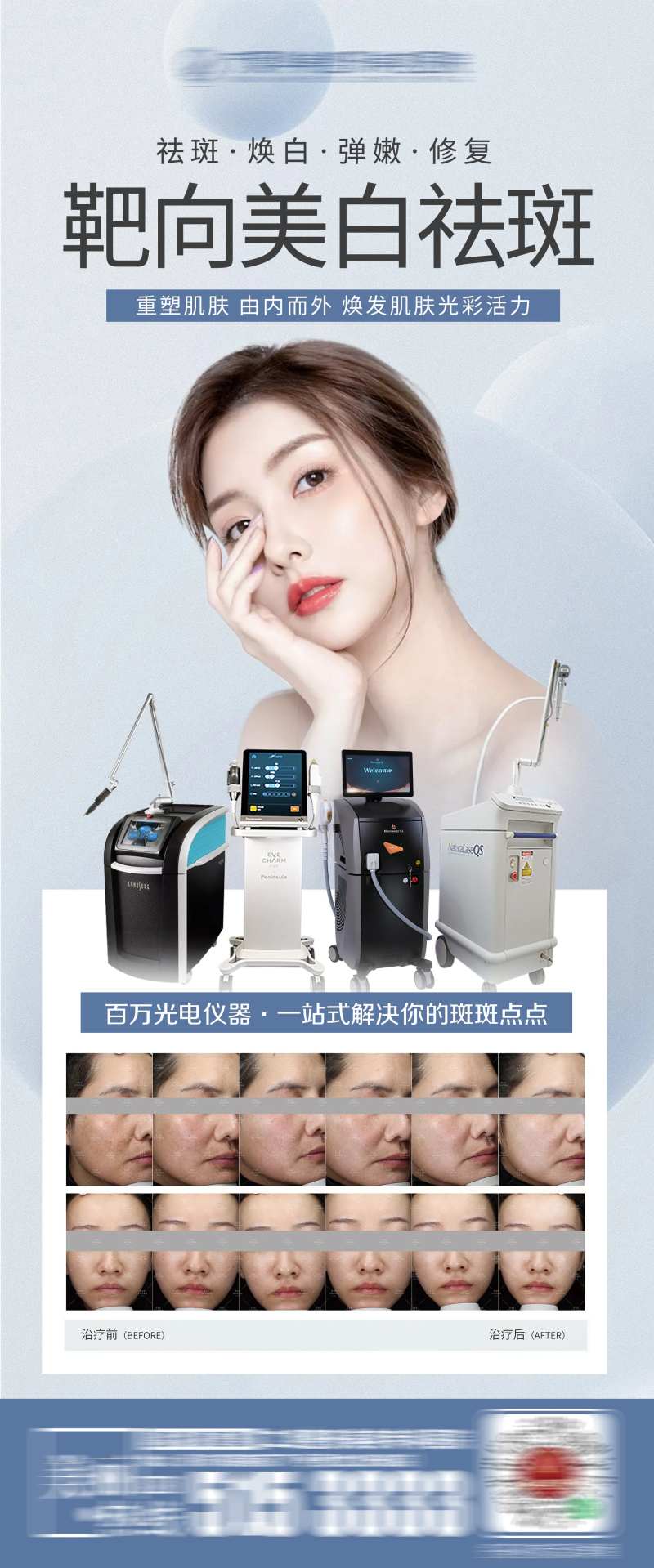 伊肤泉仪器靶向美白祛斑-采灵感-cailinggan.com