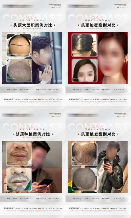 植发案例合集海报-采灵感-https://www.cailinggan.com/