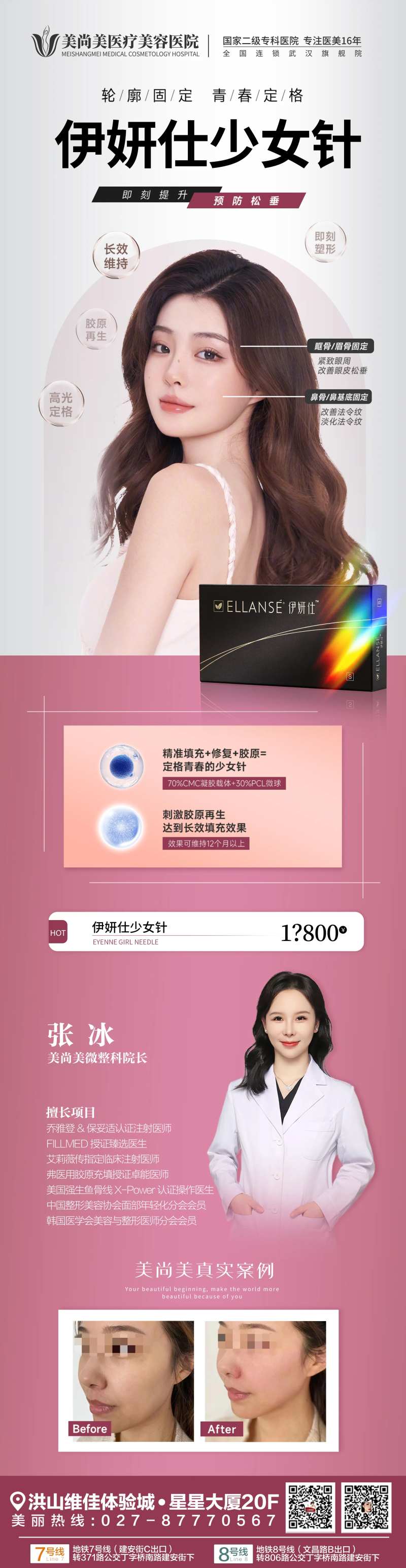 伊妍仕少女针医美长图海报-采灵感-cailinggan.com