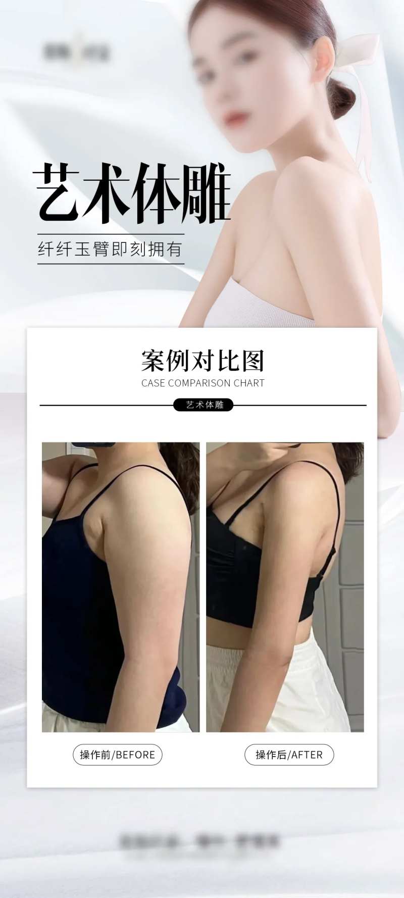 纤细手臂海报-采灵感-cailinggan.com