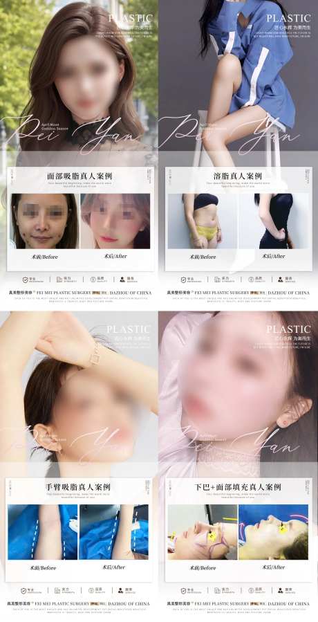 整形案例集海报-采灵感-https://www.cailinggan.com/