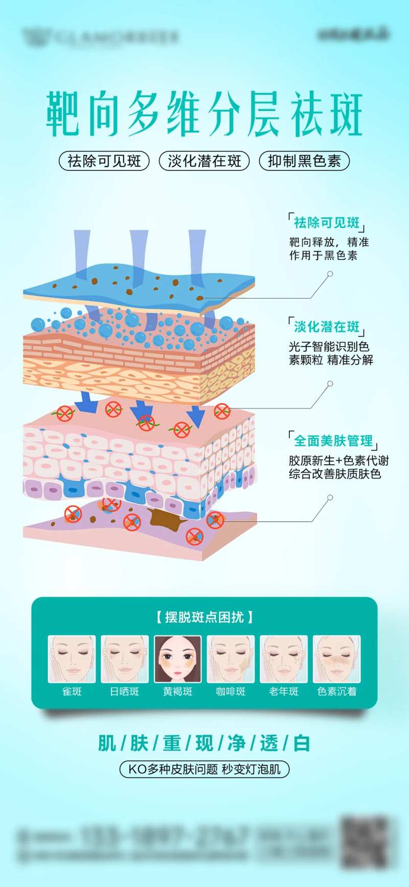 祛斑淡斑分层祛斑祛斑科普靶向-采灵感-cailinggan.com