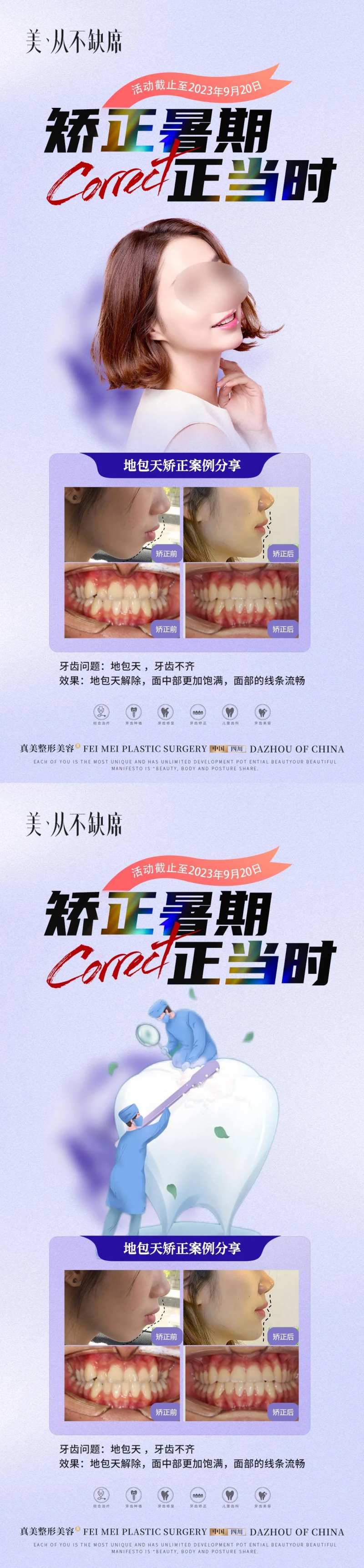 暑期夏日口腔矫正案例海报-采灵感-cailinggan.com