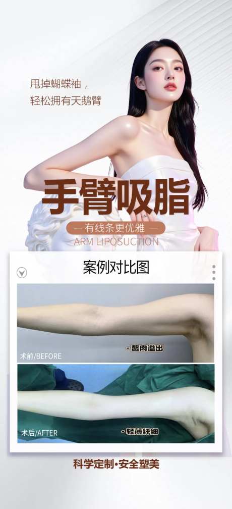 手臂吸脂案例-采灵感-https://www.cailinggan.com/