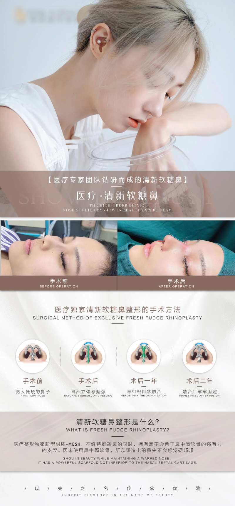 隆鼻介绍海报-采灵感-cailinggan.com