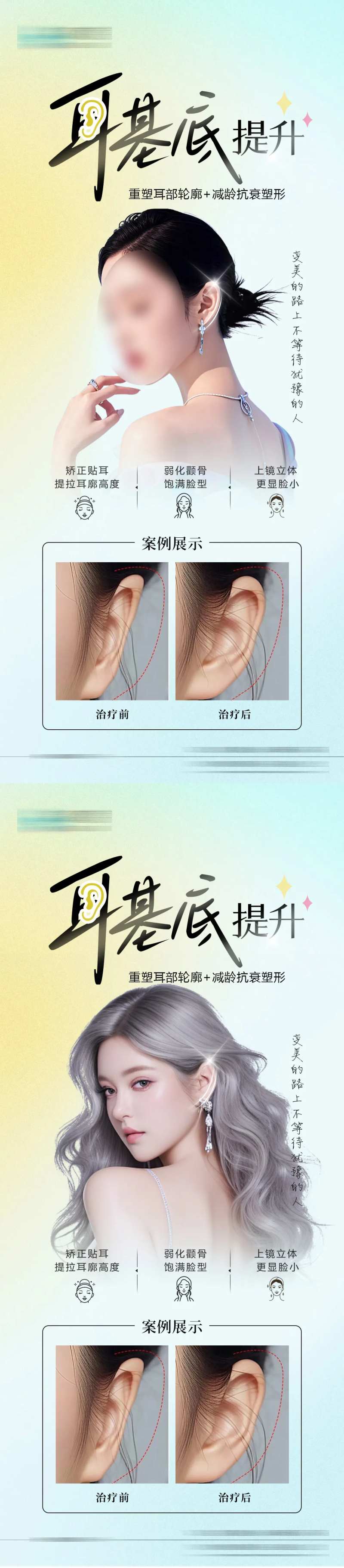 医美耳基底案例海报-采灵感-cailinggan.com