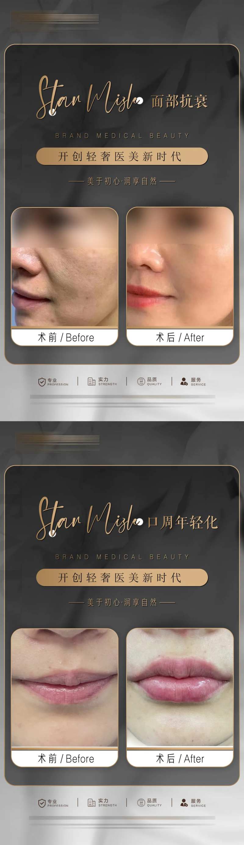 整形真人案例分享海报-采灵感-cailinggan.com