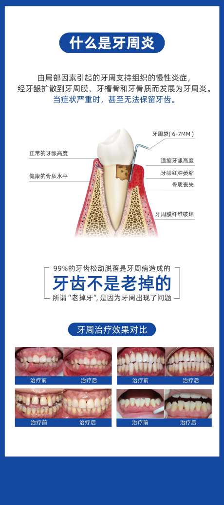 口腔牙周炎科普宣传展架-采灵感-https://www.cailinggan.com/