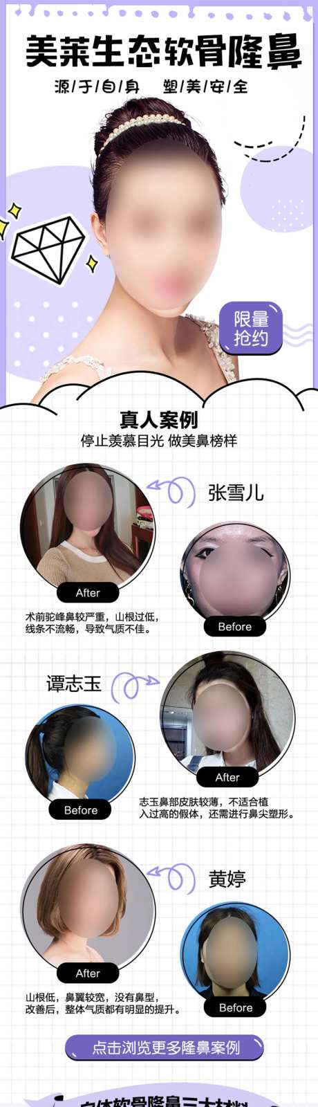 医美自体隆鼻详情页-采灵感-https://www.cailinggan.com/