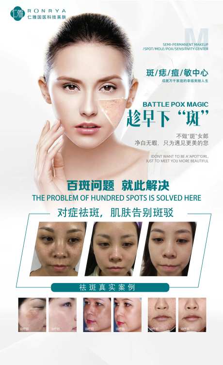 美容皮肤祛斑海报-采灵感-https://www.cailinggan.com/
