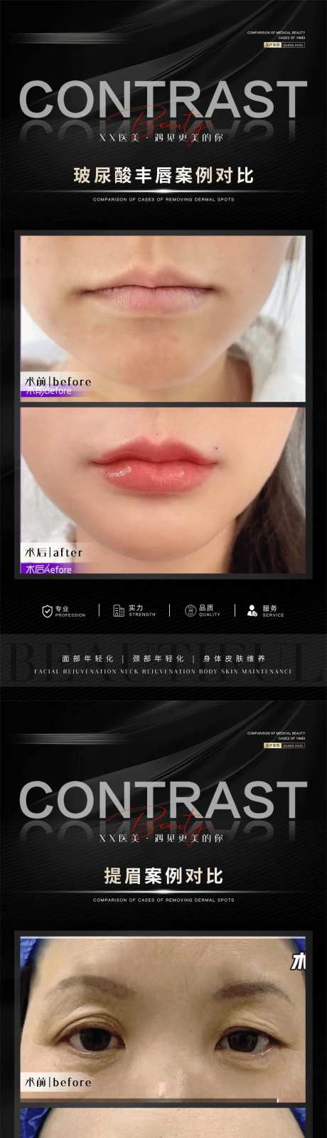 整形真人案例分享集系列海报-采灵感-https://www.cailinggan.com/