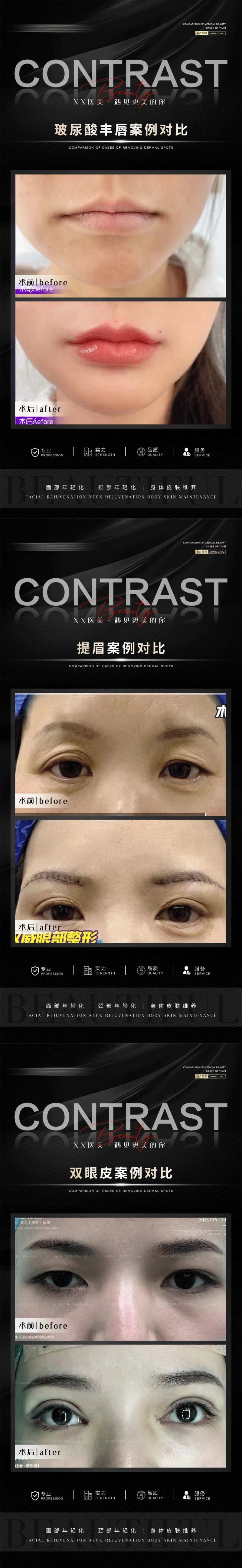 整形真人案例分享集系列海报-采灵感-cailinggan.com