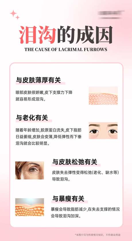 泪沟的成因医美海报-采灵感-https://www.cailinggan.com/
