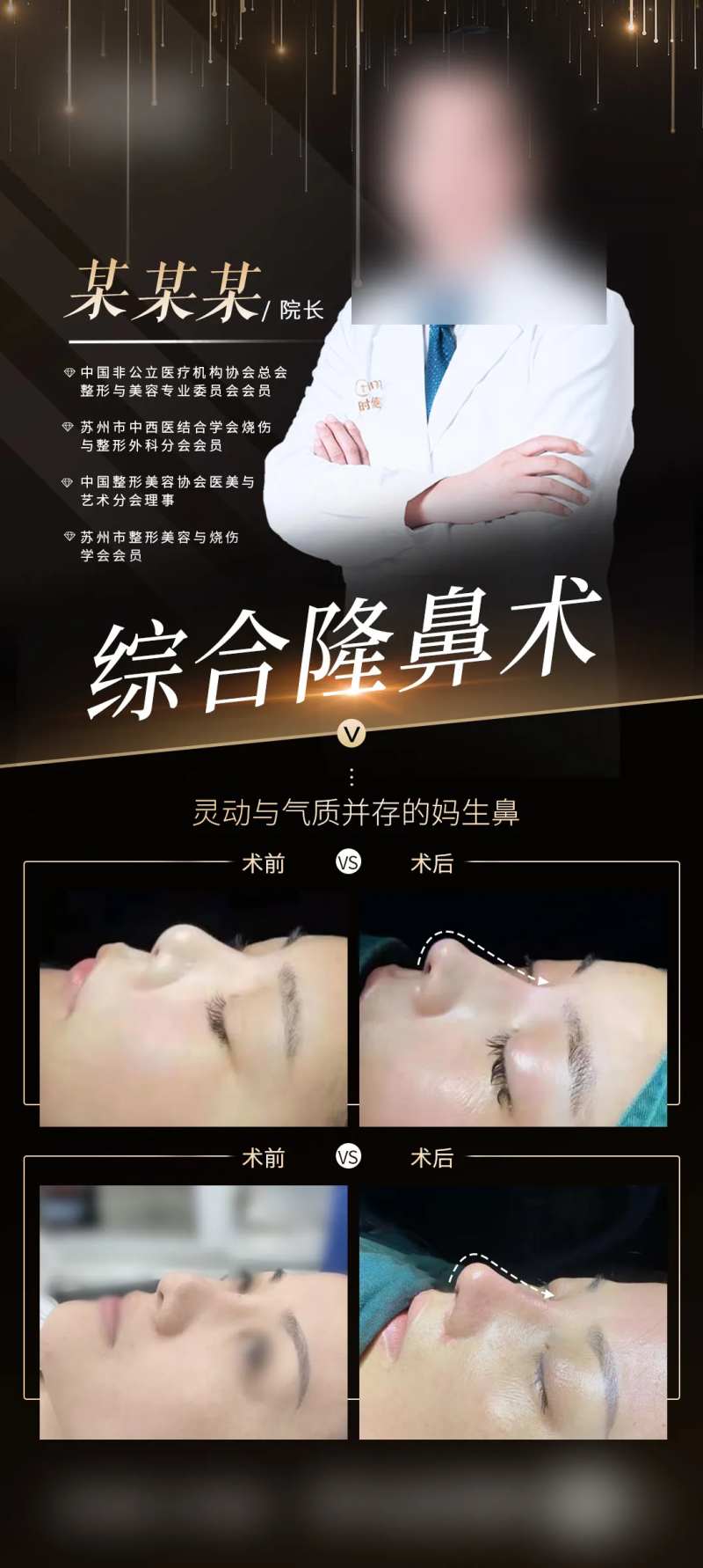 医生综合鼻案例海报-采灵感-cailinggan.com