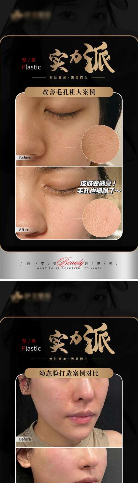 医美案例对比模版海报-采灵感-https://www.cailinggan.com/