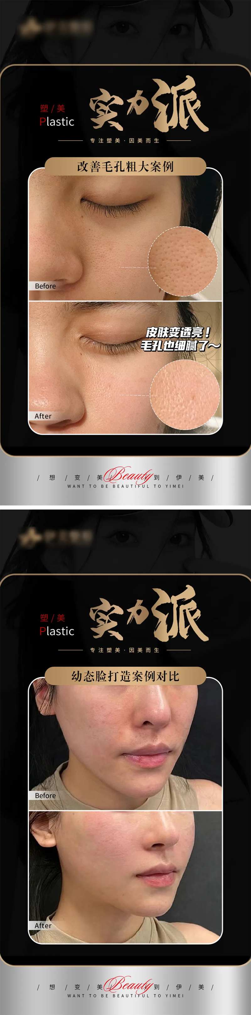 医美案例对比模版海报-采灵感-cailinggan.com