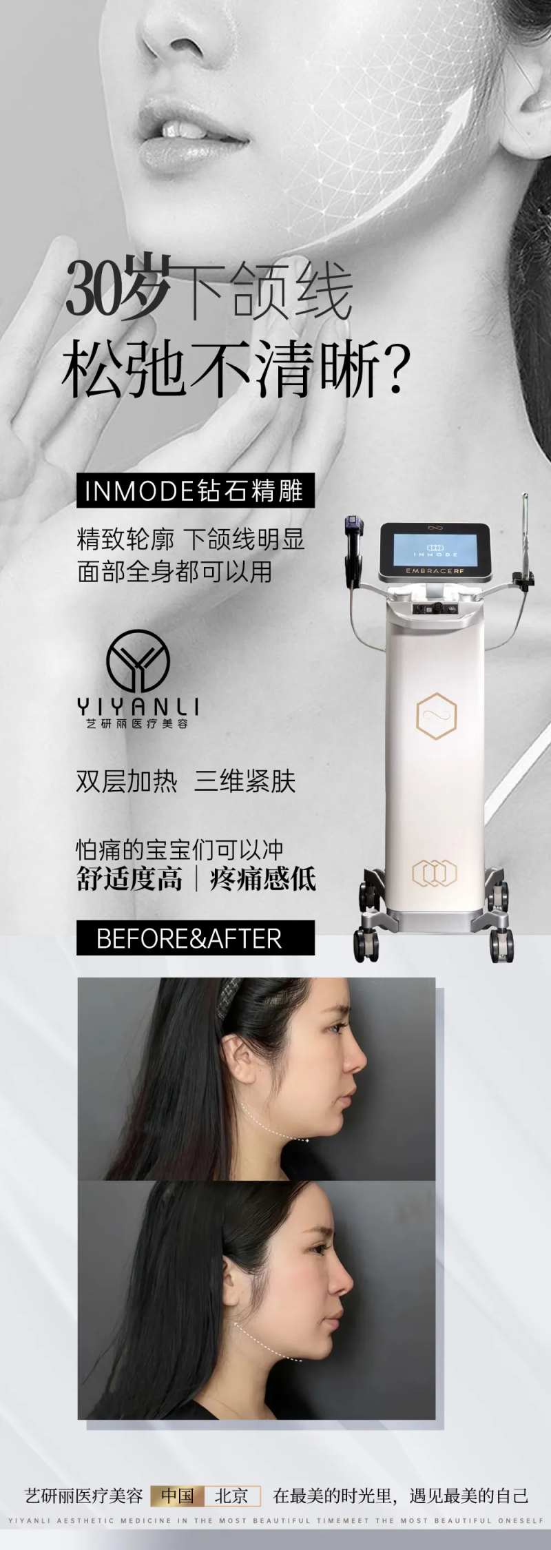 钻石超塑下颌线海报轻医美-采灵感-cailinggan.com
