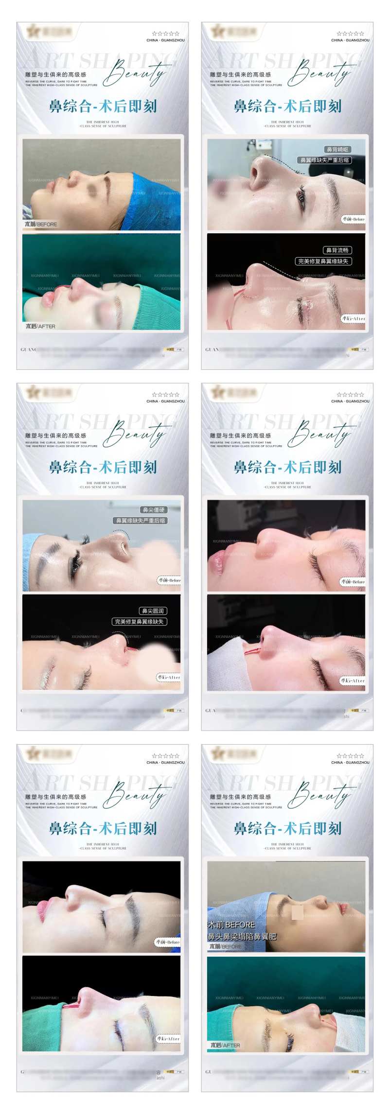 医美鼻综合整形案例海报-采灵感-cailinggan.com