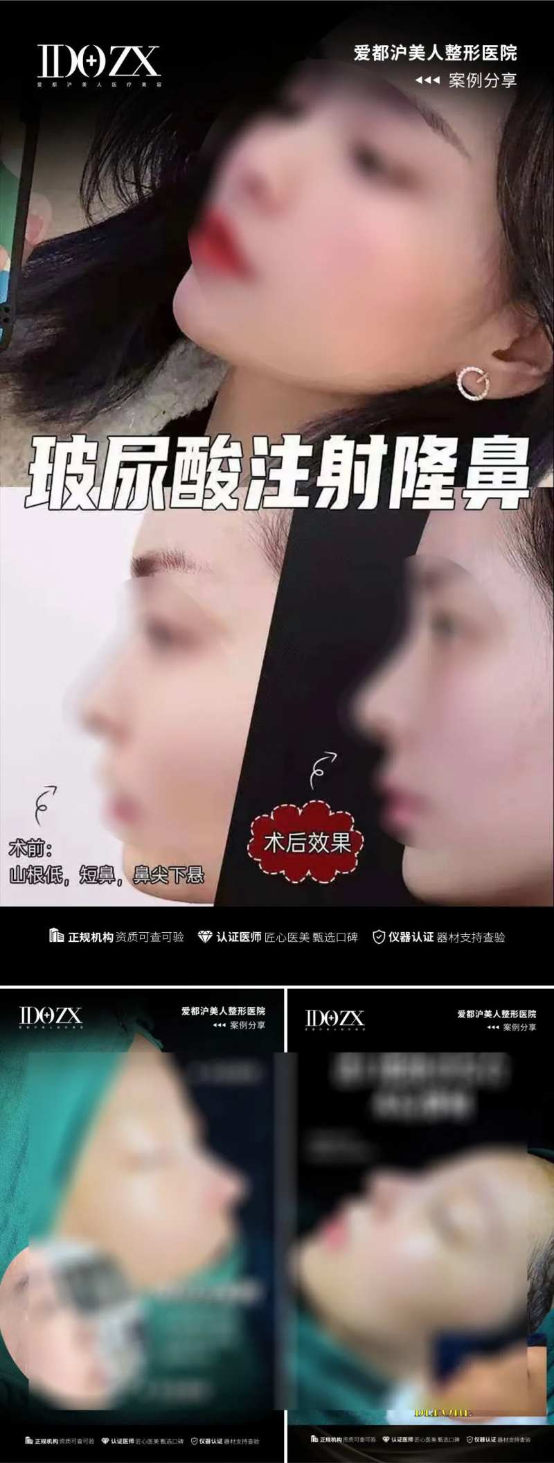 医美鼻综合案例海报-采灵感-cailinggan.com