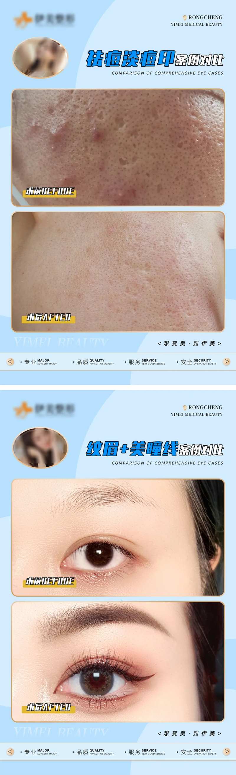 医美案例对比模版-采灵感-cailinggan.com