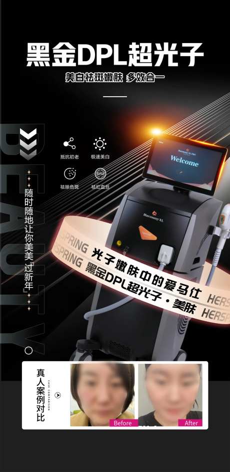 黑金DPL超光子-采灵感-https://www.cailinggan.com/