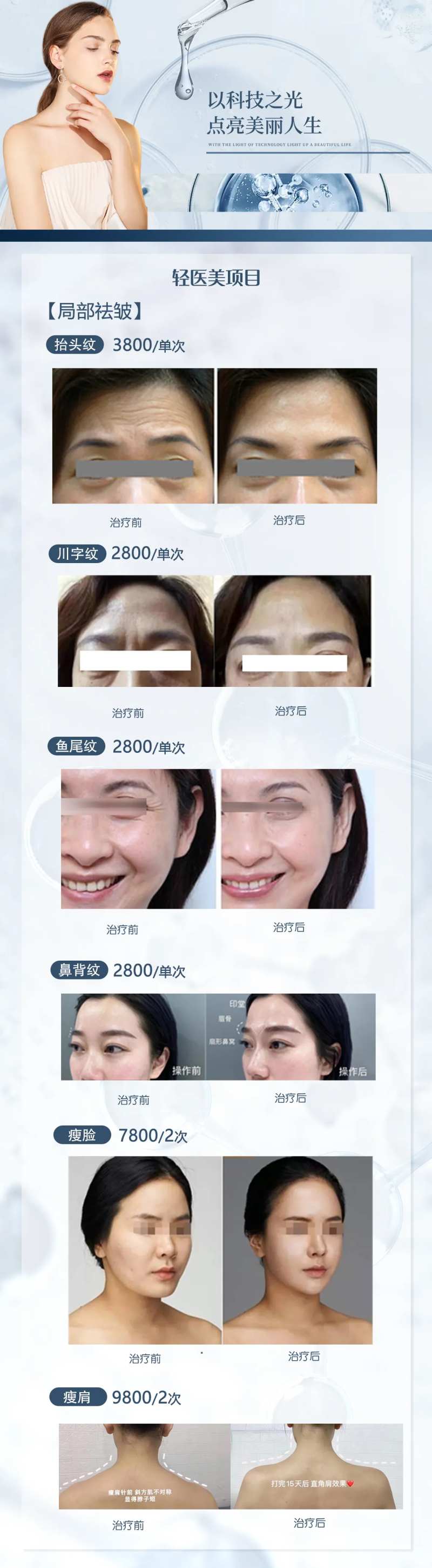 轻医美局部祛皱海报-采灵感-cailinggan.com