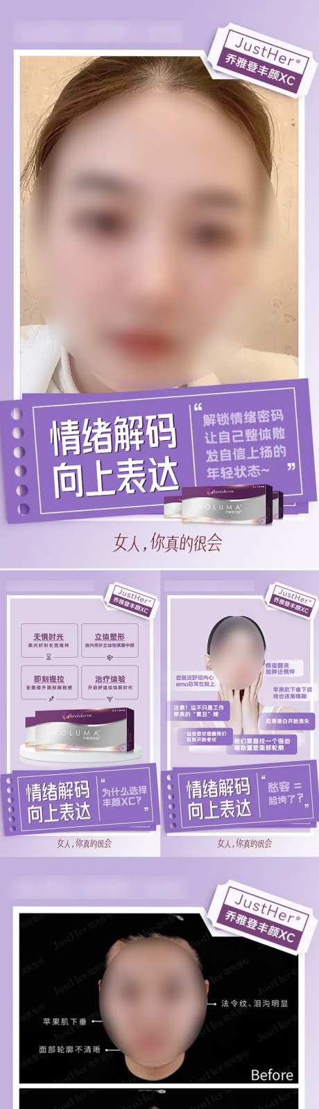微整案例宣传图-采灵感-https://www.cailinggan.com/