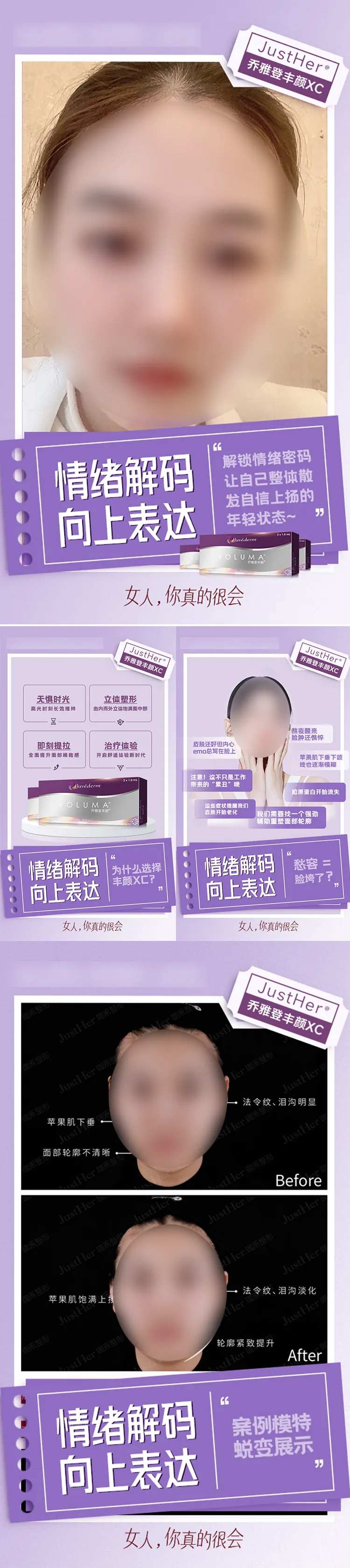 微整案例宣传图-采灵感-cailinggan.com