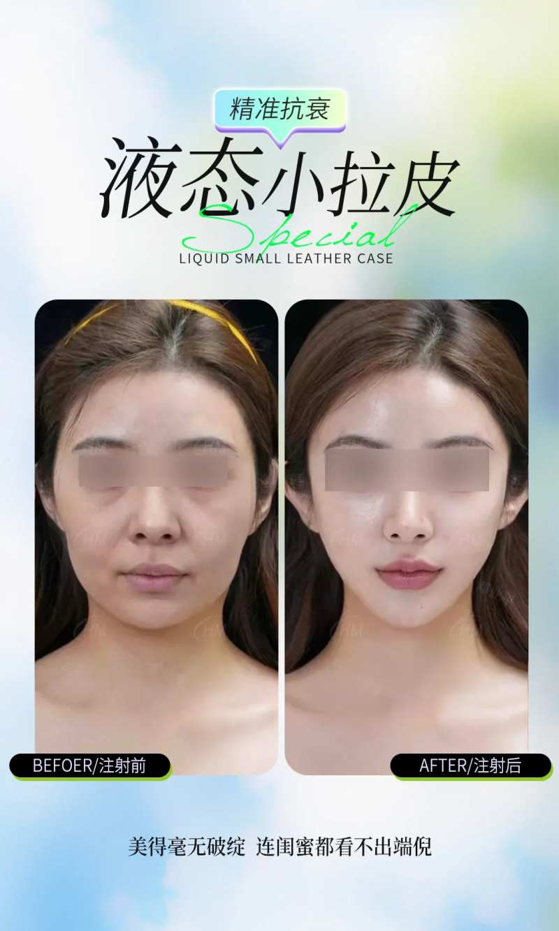 液态小拉皮案例海报-采灵感-cailinggan.com
