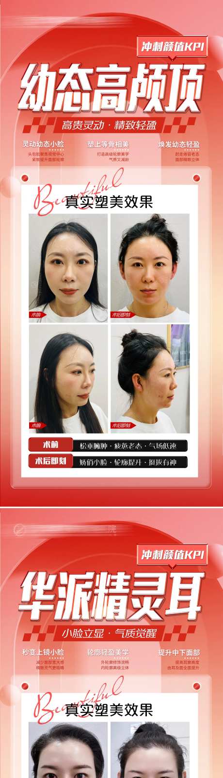 医美高颅顶海报展架-采灵感-https://www.cailinggan.com/