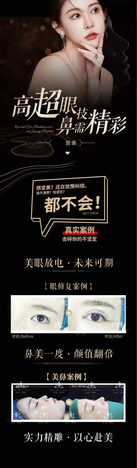医美案例鼻子长图-采灵感-https://www.cailinggan.com/