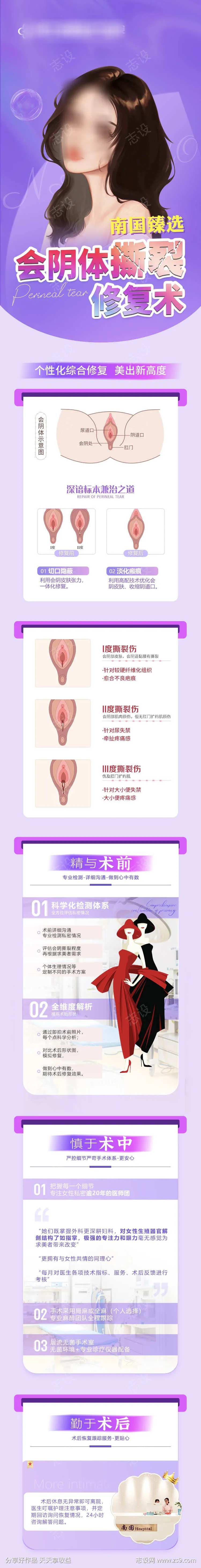 会阴体撕裂修复术-采灵感-cailinggan.com