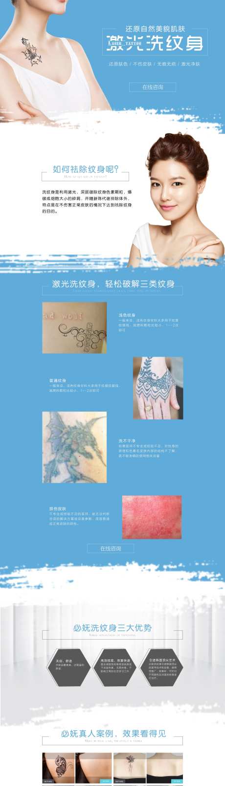 医美激光洗纹身专题页-采灵感-https://www.cailinggan.com/