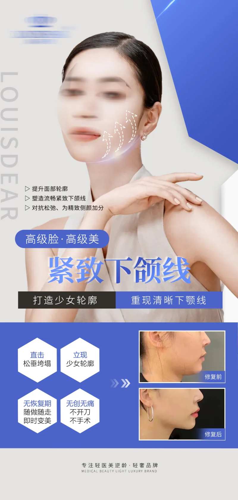 下颌线 轮廓海报-采灵感-cailinggan.com