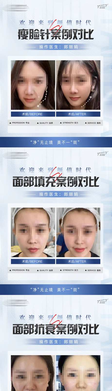 整形真人案例分享集-采灵感-https://www.cailinggan.com/