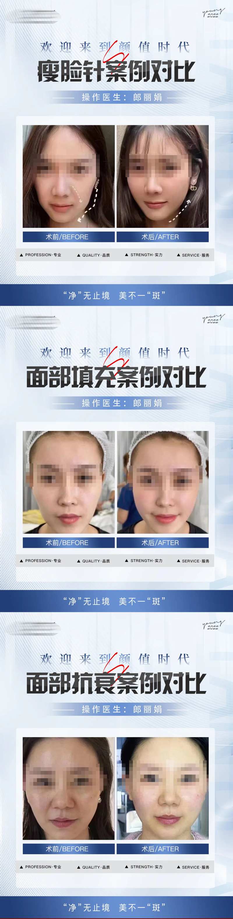 整形真人案例分享集-采灵感-cailinggan.com