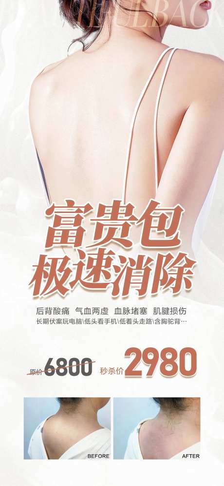 富贵包极速消除-采灵感-https://www.cailinggan.com/