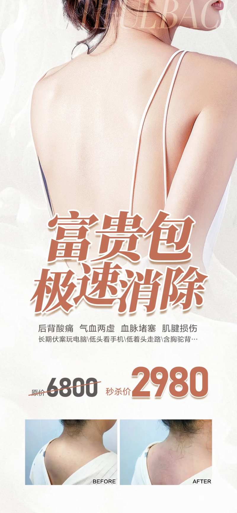 富贵包极速消除-采灵感-cailinggan.com