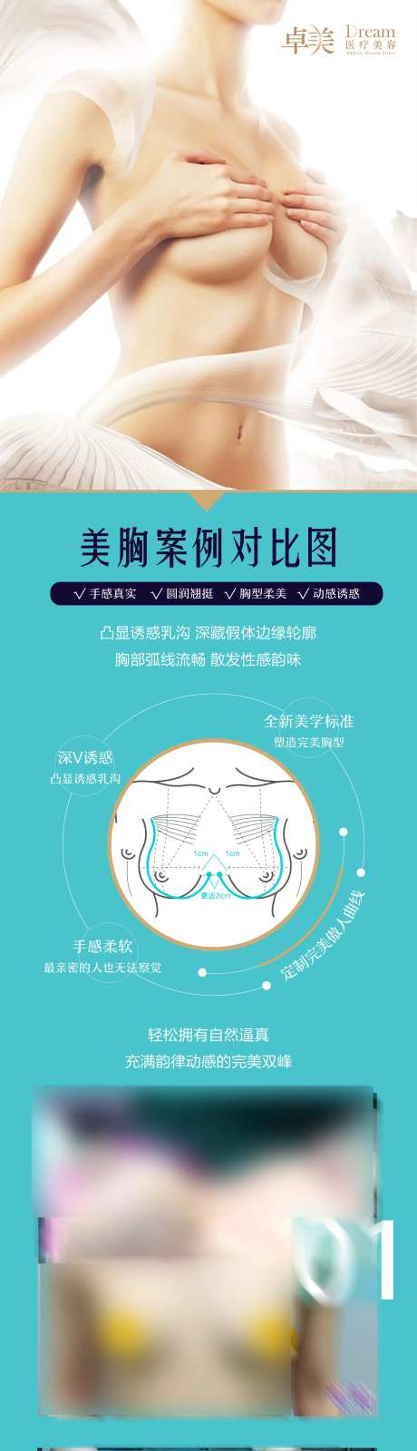 医美整形胸部案例对比图-采灵感-https://www.cailinggan.com/
