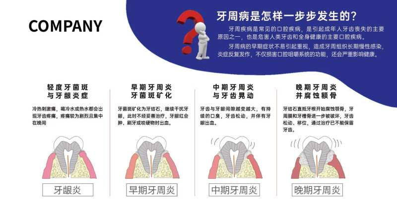 牙周病发展历程海报展板-采灵感-cailinggan.com