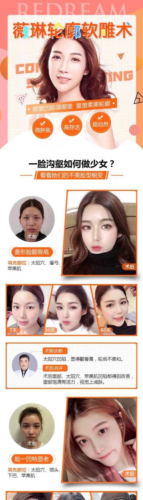 医美自体脂肪填充详情页-采灵感-https://www.cailinggan.com/