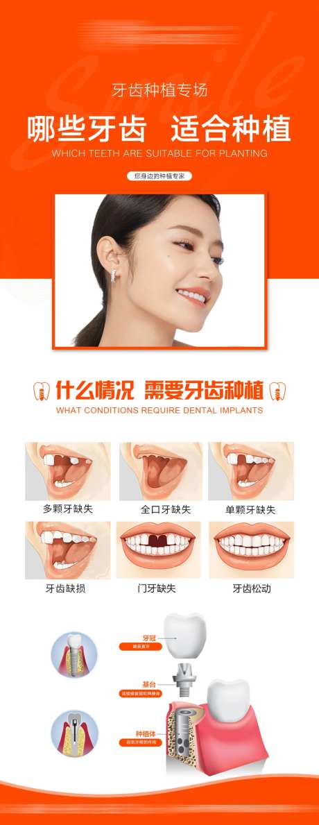 牙齿种植长图海报-采灵感-https://www.cailinggan.com/