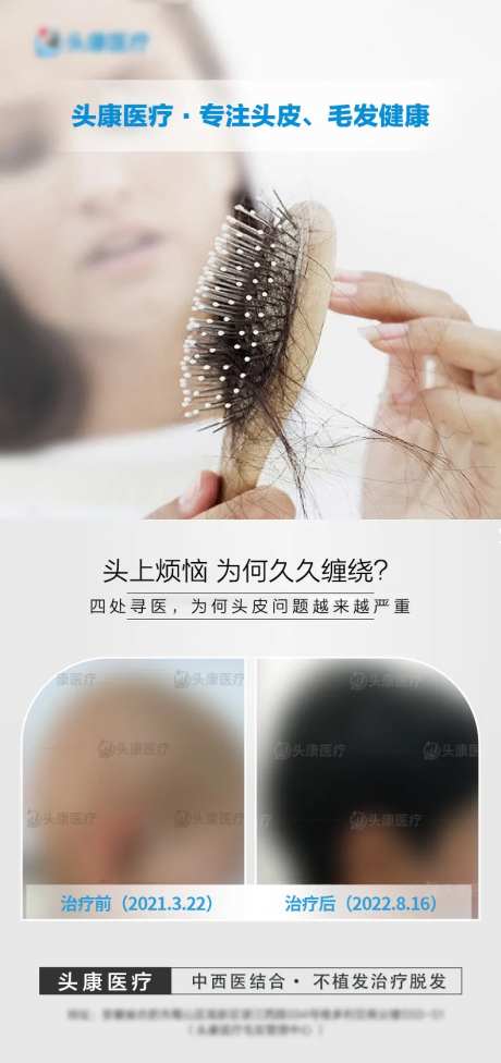治疗脱发海报-采灵感-https://www.cailinggan.com/