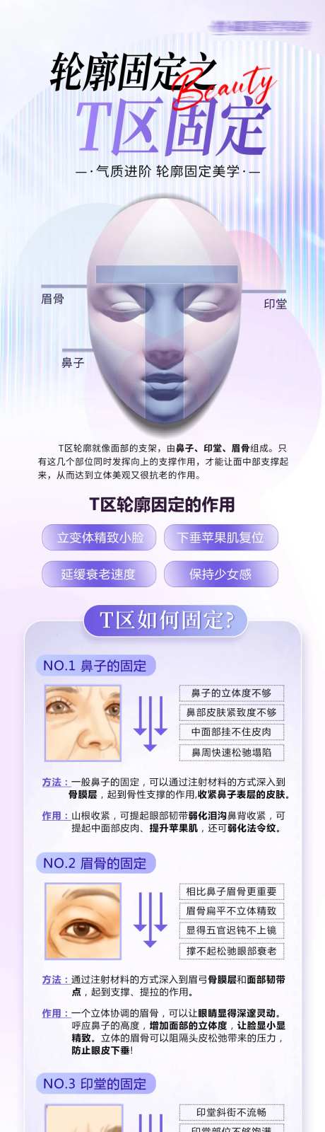 T区轮廓固定科普长图-采灵感-https://www.cailinggan.com/