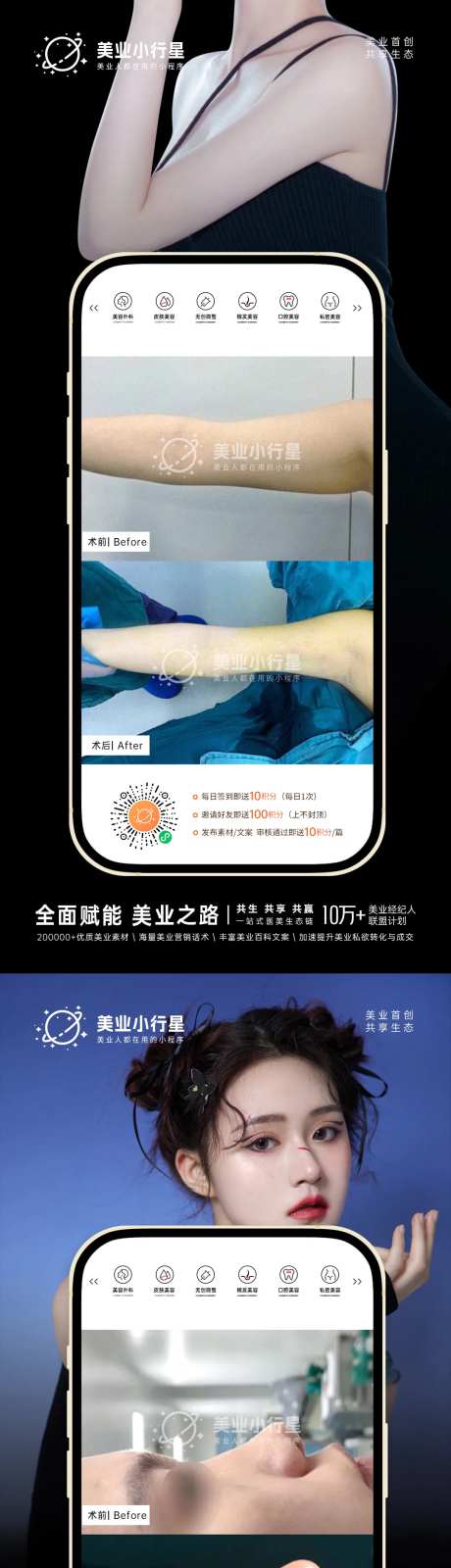 医美整形美容真人案例分享集系列海报-采灵感-https://www.cailinggan.com/