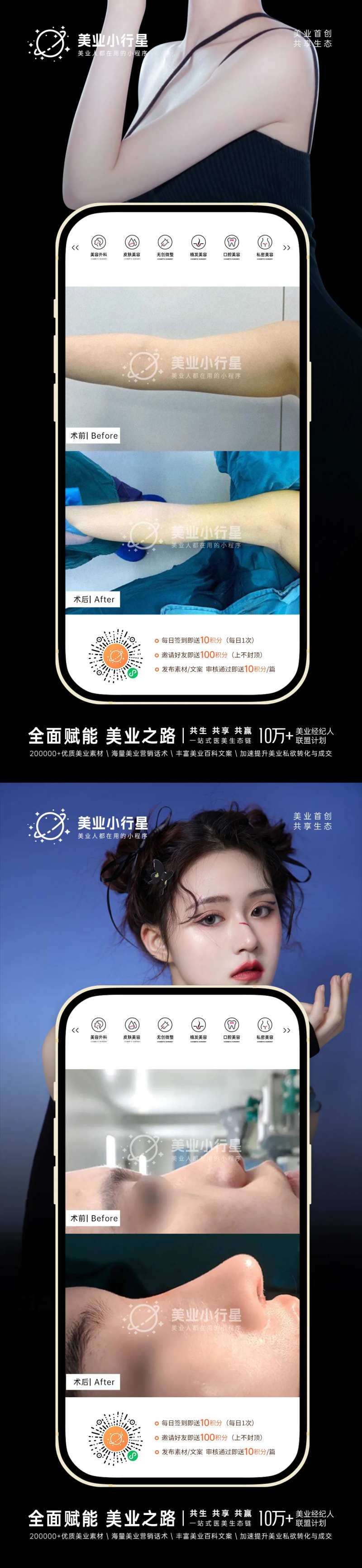 医美整形美容真人案例分享集系列海报-采灵感-cailinggan.com