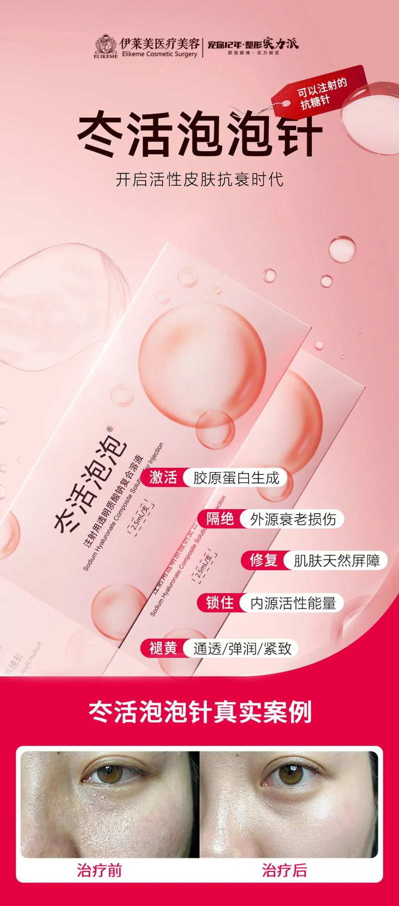 冭活泡泡针海报-采灵感-cailinggan.com