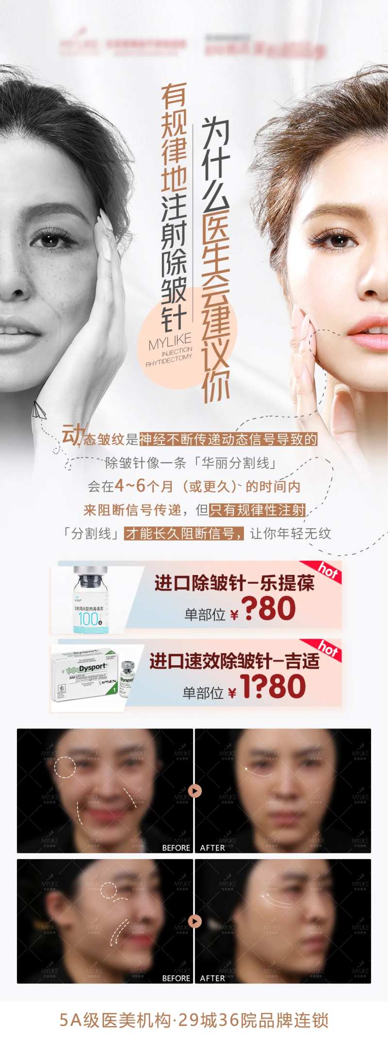 也没肉毒素除皱针朋友圈长图-采灵感-cailinggan.com