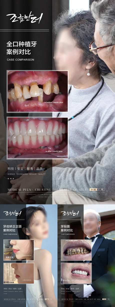 口腔案例系列海报-采灵感-cailinggan.com